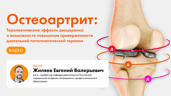 Остеоартрит: Терапевтические эффекты диацереина и возможности повышения приверженности длительной патогенетической терапии
