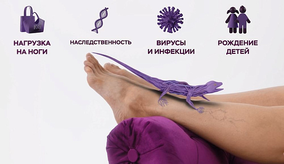 Нужны ли венотоники после перенесенной вирусной инфекции и COVID-19?